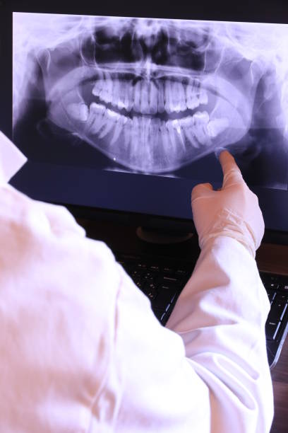 Best Emergency Treatment for Dental Infections or Abscesses in Lakeside, TX