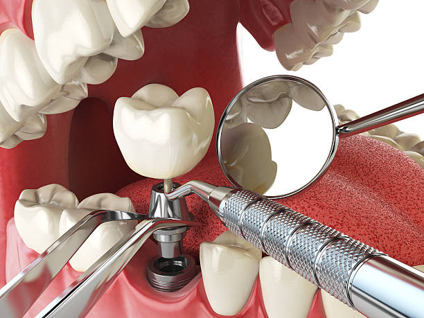 Best Weekend Emergency Dentist in Lakeside, TX